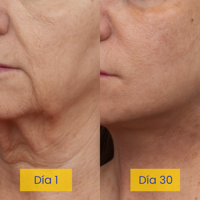 Jozyo Anti-Papada Lifting Cream