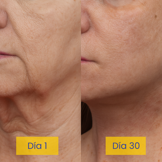 Jozyo Anti-Papada Lifting Cream