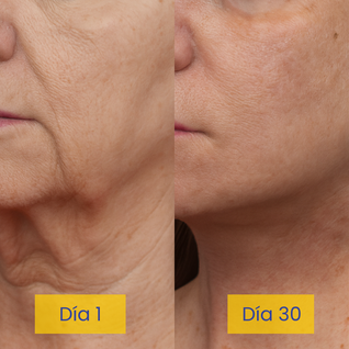 Jozyo Anti-Papada Lifting Cream